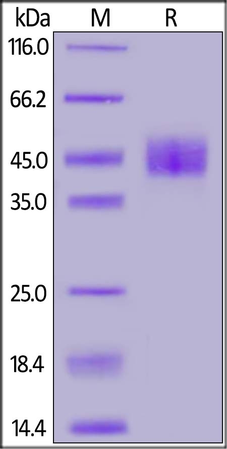Mesothelin / MSLN (298-600) Recombinant Protein