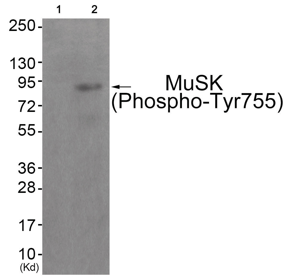 MuSK (phospho Tyr755) Antibody