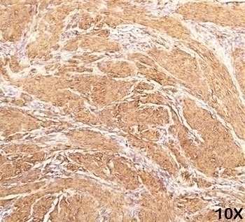 Muscle Actin Antibody [HHF35]