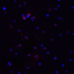 <strong>Figure 7 Immunofluorescence Validation of MyD88 in Jurkat Cells</strong><br> Immunofluorescent analysis of 4% paraformaldehyde-fixed Jurkat cells labeling MyD88 with 2127 at 20 μg/mL, followed by goat anti-rabbit IgG secondary antibody at 1/500 dilution (red) and DAPI staining (blue).
