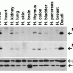 <strong>Figure 3 Independent Antibody Validation (IAV) via Protein Expression Profile in Human Tissues</strong><br>Loading: 15 μg of lysates per lane.Antibodies: MyD88 2125 (2 μg/mL), MyD88 2127 (2 μg/mL), beta-actin (1 μg/mL), and GAPDH (0.02 μg/mL), 1 h incubation at RT in 5% NFDM/TBST.Secondary: Goat anti-rabbit IgG HRP conjugate at 1:10000 dilution.