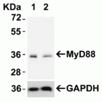 <strong>Figure 5 Validation with MyD88 siRNA Knockdown in HeLa Cells</strong><br> HeLa cells were transfected with control siRNAs (lane 1) or MyD88 siRNAs (lane 2) Loading: 10 μg of HeLa whole cell lysates per lane.Antibodies: 2125 (2 μg/mL), 1 h incubation at RT in 5% NFDM/TBST.Secondary: Goat anti-rabbit IgG HRP conjugate at 1:10000 dilution.