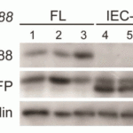 <strong>Figure 11 KO Validation in Mouse IECs (Vlantis et al., 2014) </strong><br>Western blot with anti-MyD88 antibodies on intestinal epithelial cells (IECs) showing efficient deletion of MyD88 and concomitant expression of GFP in MyD88IEC-KO mice, but not in MyD88 knockout mice.