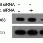 <strong>Figure 12 KD Validation in Chondrocytes (Ahmad et al., 2009) </strong><br>Chondrocytes were transfected with either MyD88 siRNA or control siRNA and analyzed for MyD88 expression by immunoblotting with anti-Myd88 antibodies that confirmed inhibition of the target proteins.