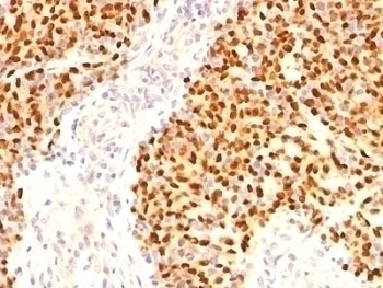 Myogenin Antibody [F5D]