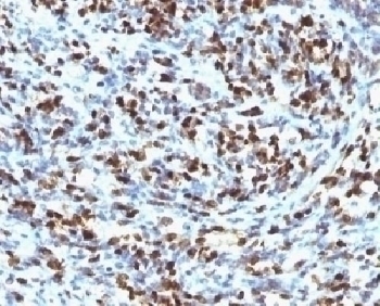 Myogenin Antibody [MGN185]