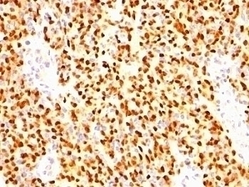 Myogenin Antibody [SPM144]