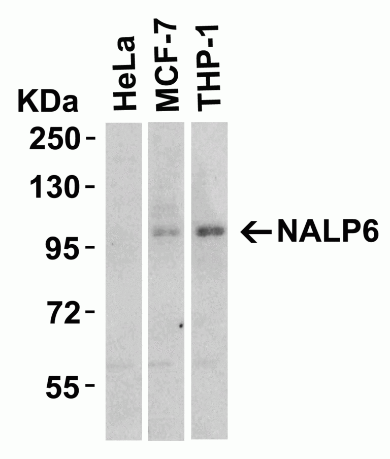 NALP6 Antibody