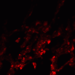 Immunofluorescence of NDFIP1 in human lung tissue with NDFIP1 antibody at 20 μg/ml.