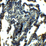 Immunohistochemistry of NDFIP1 in human lung tissue with NDFIP1 antibody at 5 μg/ml.