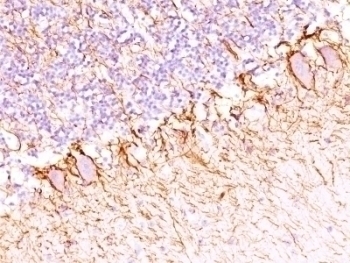NF-H Antibody [SPM203]