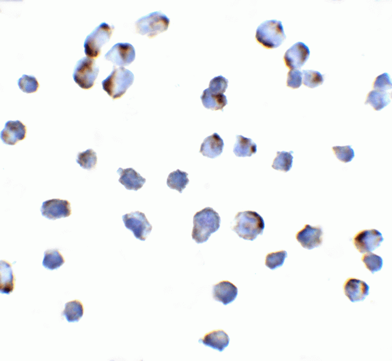 NIK Antibody