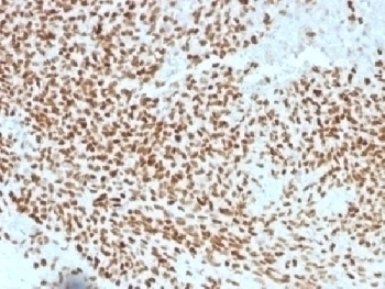 NKX2.2 Antibody [NX2/1523]