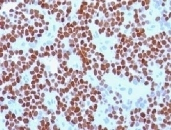 NKX2.2 Antibody [NX2/294]