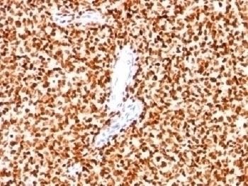 NKX2.2 Antibody [SPM564]