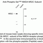 Western blot of mouse brain lysate showing specific immunolabeling of the ~140k NR2C subunit of the NMDA receptor phosphorylated at Ser1096.  In the second lane immunoreactivity is blocked by preadsorption with the phospho-peptide (Peptide) used as antigen.