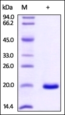 NME1 Recombinant Protein