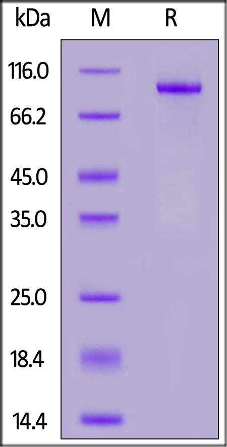 NOTCH1 Recombinant Protein