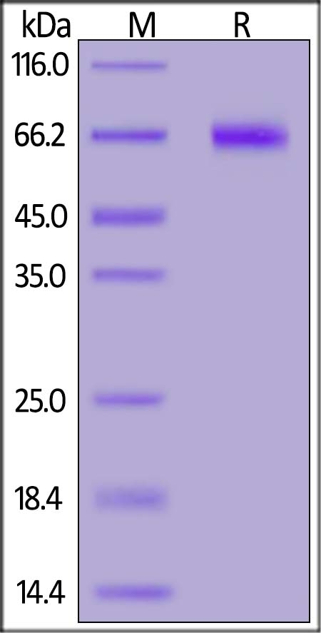 NOTCH1 Recombinant Protein