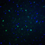 Immunofluorescence of NOX2 in rat brain tissue with NOX2 antibody at 20 μg/ml.<br><br>Green: NOX2 Antibody (7923) <br> Blue: DAPI staining