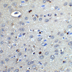 Immunohistochemistry of NOX2 in rat brain tissue cells with NOX2 antibody at 2 μg/ml.