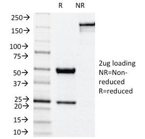 NOX4 Antibody [NX2/1524]