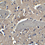 <strong>Figure 7 Immunohistochemistry Validation of NPTX2 in Mouse Brain Tissue </strong><br> Immunohistochemical analysis of paraffin-embedded mouse brain issue using anti-NPTX2 antibody (4573) at 5 μg/ml. Tissue was fixed with formaldehyde and blocked with 10% serum for 1 h at RT; antigen retrieval was by heat mediation with a citrate buffer (pH6). Samples were incubated with primary antibody overnight at 4°C. A goat anti-rabbit IgG H&L (HRP) at 1/250 was used as secondary. Counter stained with Hematoxylin.