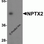 <strong>Figure 3 Western Blot Validation in Mouse Brain Tissue Lysate</strong><br>Loading: 15 μg of lysates per lane.Antibodies: NPTX2 4573 (1 μg/mL), 1h incubation at RT in 5% NFDM/TBST.Secondary: Goat anti-rabbit IgG HRP conjugate at 1:10000 dilution.A: Absence of blocking peptide B: Presence of blocking peptide.