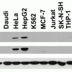 <strong>Figure 2 Independent Antibody Validation (IAV) via Protein Expression Profile in Cell Lines</strong><br>Loading: 15 μg of lysates per lane.Antibodies: NPTX2 4573 (2 μg/mL), NPTX2 64-234 (4 μg/mL), and beta-actin 3779 (1 μg/mL),  1h incubation at RT  in 5% NFDM/TBST.Secondary: Goat anti-rabbit IgG HRP conjugate at 1:10000 dilution.