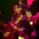 Immunostaining of HEK293 cells with anti-NSE (red) and anti-mouse UCHL1 (green) (Cat. No. 50-263) antibodies.