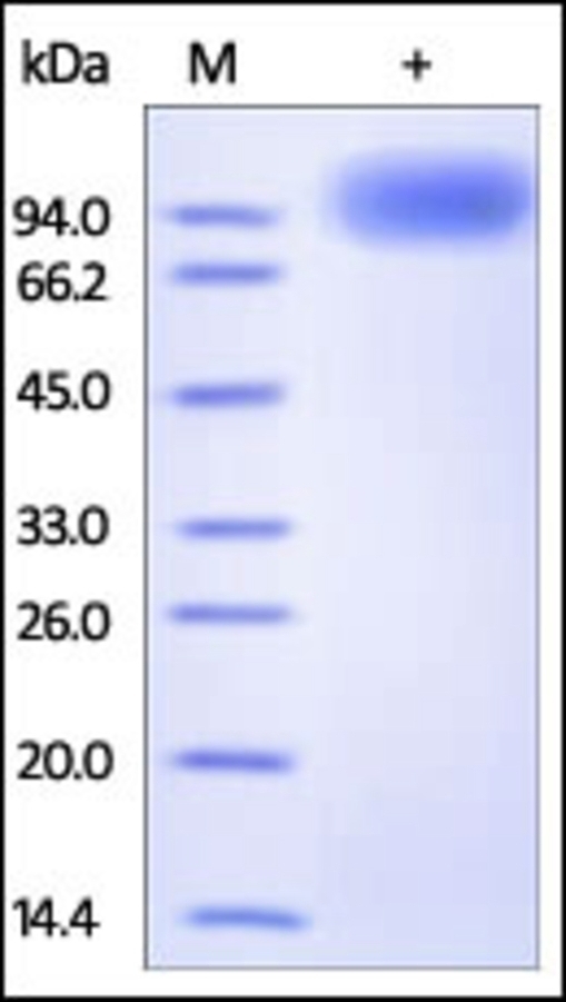 NTRK2 Recombinant Protein
