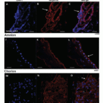 <strong>Figure 8 Immunolocalization Validation of Nephrin in Human Placenta (Yun et al., 2015)</strong><br>Immunofluorescence staining showed Nephrin expression detected by anti-nephrin antibodies (2265) was clearly localized in villi (A-C) and fetal membranes, Amnion (J-L) and Chorion (M-O).  The staining was markedly positive at apical membrane of villi (arrows in B and C) and amnion (arrow in L), and in the stromal cells of chorion (small arrow in O).