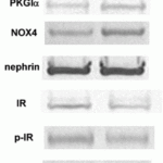 <strong>Figure 12 WB Validation of Nephrin in Glomeruli of Zucker Obese (ZO) and Zucker Lean (ZL) Rats (Piwkowska et al., 2013)</strong><br>The expression of nephrin detected by anti-nephrin antibodies did not change in ZO rats as compared to the control rats.