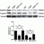 <strong>Figure 14  Regulated Expression Validation of Nephrin in Mouse Podocyte Cells Cultured in Normal Glucose (NG) Medium or High Glucose (HG) Medium (Huang et al., 2019) </strong><br>Western Blot analysis was used to access the protein expression level of nephrin with anti-nephrin antibodies. Nephrin expression was down-regulated by PEGF treatment (NGP or HGP), which was reversed by the addition of C3 transferase.