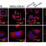 <strong>Figure 5  Immunofluorescence Validation of Nephrin in mouse podocyte clone 5 (MPC5) cells (Li et al, 2013) </strong><br> Double immunofluorescence  analysis of podocytic membrane protein nephrin (red) and nuclei stained with DAPI (blue).  The presence of high glucose (HG) and neutralizing antibody (NtAb) which blocked epithelial growth factor(EGF) decreased nephrin expression while mesenchymal stem cells-conditioned medium (MSCs-CM) and recombinant human EGF (rhEGF) prevented the effect.