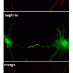 <strong>Figure 7 Immunofluorescence and Localization Validation of Nephrin in cultured rat podocytes (Piwkowska et al., 2012)</strong><br>Immunofluorescence staining showed Nephrin expression (green) detected by anti-nephrin antibodies and PKGIalpha (red).  The co-localization of two antibodies (yellow) in rat podocytes was observed particularly at the tips of the cell processes.