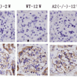 <strong>Figure 9 Immunohistochemistry Validation of Nephrin in  mouse kidneys (Toyama et al., 2012) </strong><br>Protein analysis for nephrin  by immunohistochemistry with anti-nephrin antibodies  in kidneys of wild-type or AMPD2-deficient mice at 2, 12 or 24 weeks of age.  No difference between wild-type andAMPD2-deficient mice at any age was observed.