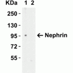 <strong>Figure 1 Western Blot Validation in HeLa Cell Lysate with (A) the Absence and (B) the Presence of Blocking Peptide</strong><br>Loading: 15 μg of lysates per lane.Antibodies: Nephrin 7979 (1 μg/mL), 1h incubation at RT in 5% NFDM/TBST.Secondary: Goat anti-rabbit IgG HRP conjugate at 1:10000 dilution.