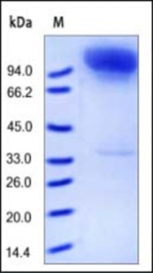 Neprilysin Recombinant Protein