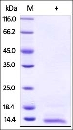 Neuregulin-4 Recombinant Protein