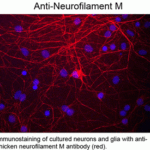 Immunostaining of cultured neurons and glia with anti-chicken neurofilament M antibody (red).