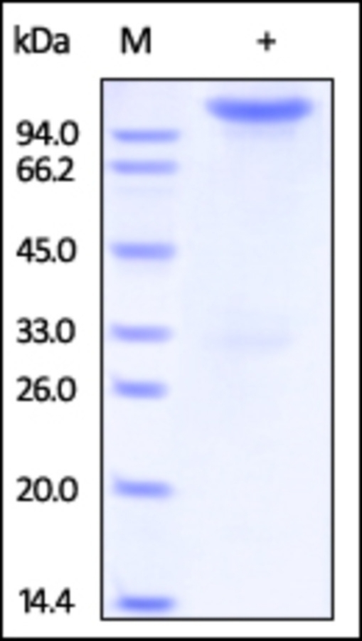 Neuropilin 1 Recombinant Protein