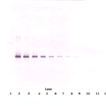 To detect hNeuroserpin by Western Blot analysis this antibody can be used at a concentration of 0.1 - 0.2 ug/ml. Used in conjunction with compatible secondary reagents the detection limit for recombinant hNeuroserpin is 1.5 - 3.0 ng/lane, under either reducing or non-reducing conditions.