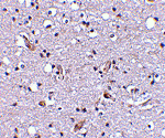 Immunohistochemical staining of human brain tissue using Nhe-1 antibody at 2.5 μg/mL.