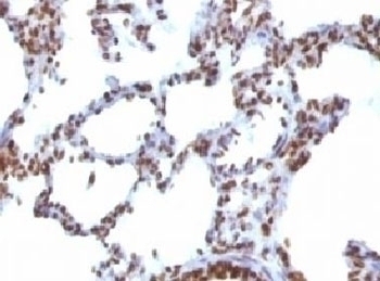 Nuclear Antigen Antibody [NUCM1-1]