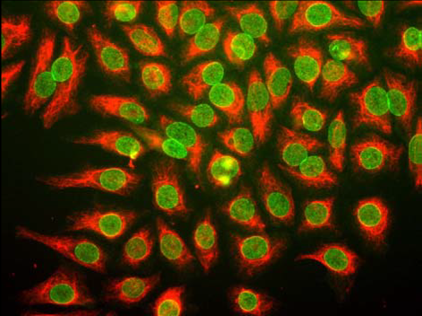 Nuclear pore Complex Antibody [39C7]