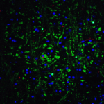 Immunofluorescence of OLIG2 in mouse brain tissue with OLIG2 Antibody at 20 μg/mL.<br><br>Green: OLIG2 antibody (7743) <br> Red: Phylloidin staining<br> Blue: DAPI staining