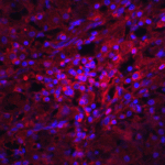 Immunohistochemistry of ORAI1 in human spleen tissue with ORAI1 antibody at 2.5 μg/mL.