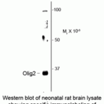 Western blot of neonatal rat brain lysate showing specific immunolabeling of the ~32k Olig2 protein.