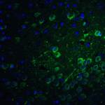 Immunofluorescence of PACS1 in mouse brain tissue with PACS1 antibody at 20 μg/ml.<br><br>Green: PACS1 Antibody (8187) <br> Blue: DAPI staining